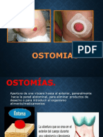 Ostomias