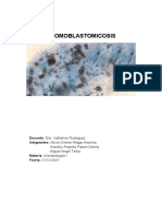 CROMOBLASTOMICOSIS