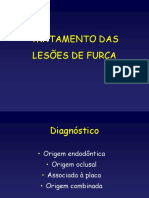 Lesões de Furca