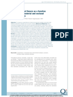 Premolar Cuspal Flexure As A Function of Restorative Material and Occlusal Contact Location