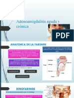 Adenoamigdalitis Aguda y Cronica