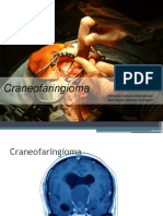 CRANEOFARINGIOMA