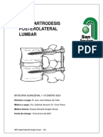 Artrodesis Posterolateral