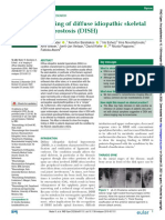 Imaging of Diffuse Idiopathic Skeletal Hyperostosis (DISH) : Original Research