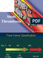 Stent Thrombosis: Dr. Surinder Singh