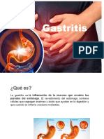 Gastritis