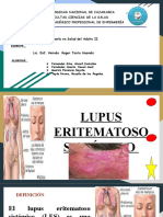 Lupus Eritematoso Sistémico