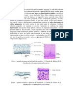 Histología Cáncer de Cérvix