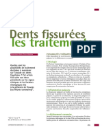 Dents Fissurées Traitements