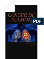 Cáncer de Pulmón