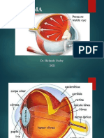 Glaucoma 2021