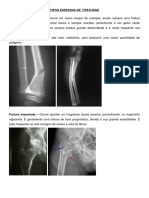 Apostila Traumatologia Geral 2014 Ibmr.-1