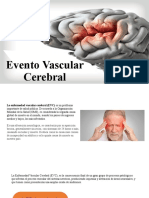 Evento Vascular Cerebral