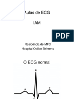 ECG IAM Parte 1