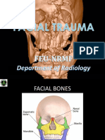 Facial Trauma - 2ND Lecture