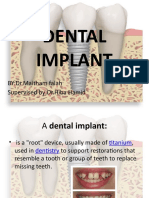 Vdocuments - MX Dental Implant 592632ae09497