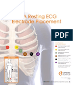 Ecg Placements