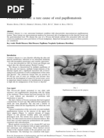 Cowden S Disease A Rare Cause of Oral Sis 2002 Journal of Laryngology and Otology