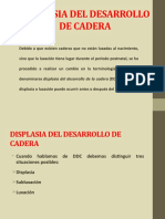 Displasia Del Desarrollo de Cadera