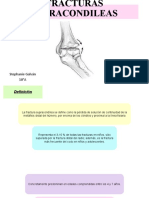 FX Supracondi