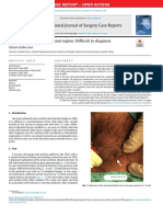 Pilonidal Sinus