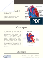 Tetralogía de Fallot