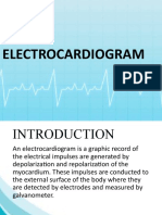 Electrocardiogram