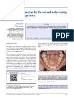 Scissor Bite Correction For The Second Molars Using Simplified RM Appliance