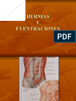 Hernias y Eventraciones en Power Point