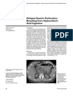 Delayed Gastric Perforation Resulting From Hydrochloric Acid Ingestion