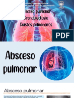 Absceso Pulmonar