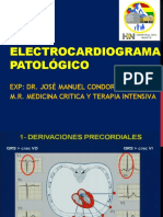 Ecg Patologico