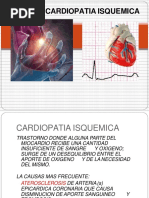 Cardiopatia Isquemica