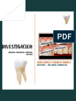 Investigacion Atriccio, Abrasion, Erosio, Abfraccion