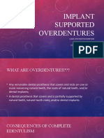 Implant Supported Overdentures