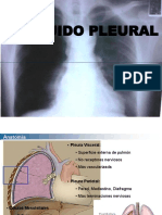 Liquido Pleural