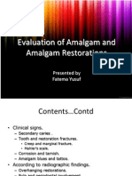 Evaluation of Amalgam and Amalgam 2s