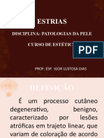 Aula 8 - Estrias