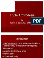 Triple Arthrodesis