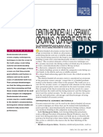 Dentin-Bonded All-Ceramic: Crowns: Current Status