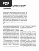 Effects On The Periodontium Following Corticotomy Facilitated Orthodontics. Case Reports