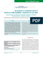 Técnica de Boyne: Una Alternativa en El Tratamiento Abierto de Fracturas de Cóndilo Mandibular. A Propósito de Un Caso Clínico