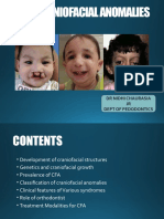 Craniofacial Anomalies: DR Nidhi Chaurasia JR Dept of Pedodontics