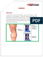 Monografia de Varices