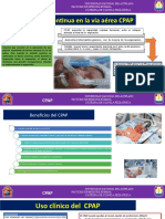 CPAP Ventilacion Mecanica y Oxigenoterapia