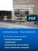 02 Gingivoperiostioplastia