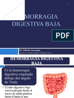 Hemorragia Digestiva Baja