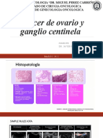 Cancer de Ovario Ganglio Centinela