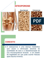 OSTEOPOROSE Trabalho Slide