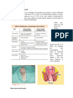 Fístulas Intestinales